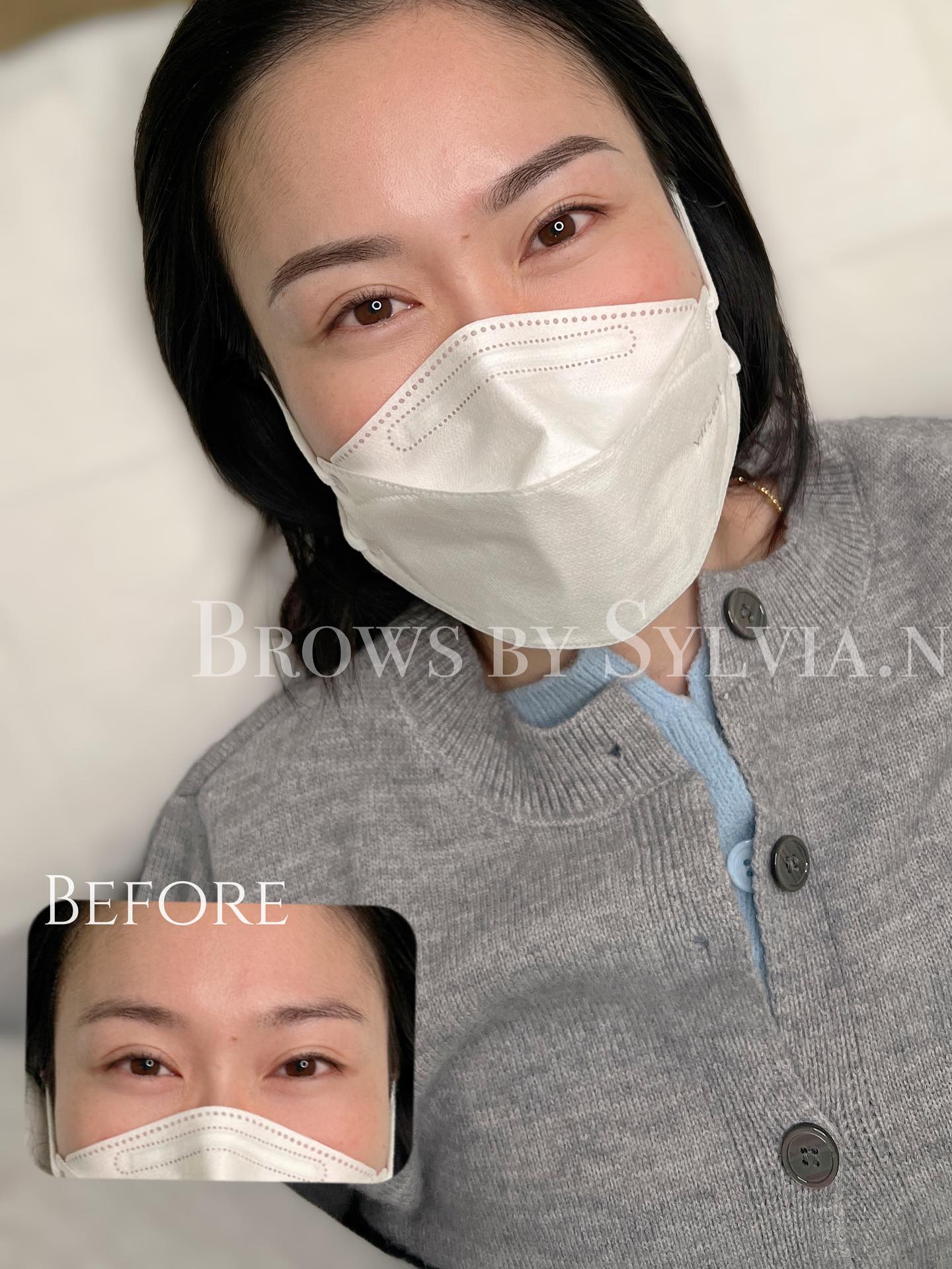 Brow transformation